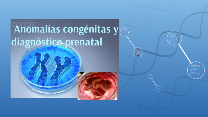 Anomalías Congénitas Y Diagnóstico Prenatal By Mayolo Fernández Ruiz On Prezi