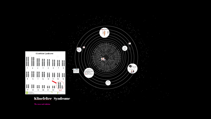 Klinefelters Syndrome By Jeanne James On Prezi