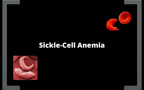 Sickle-Cell Anemia and your Newborn Child by Delayna Loveland