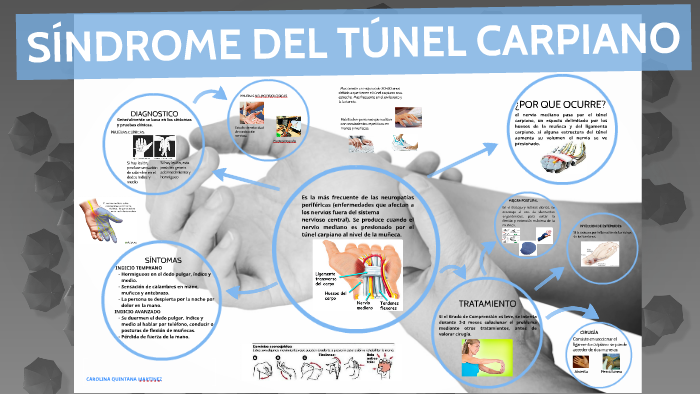 Síndrome Del Túnel Carpiano Care Guide Information En Espanol