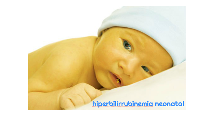 hiperbilirrubinemia neonatal by Luisa Flor on Prezi Next