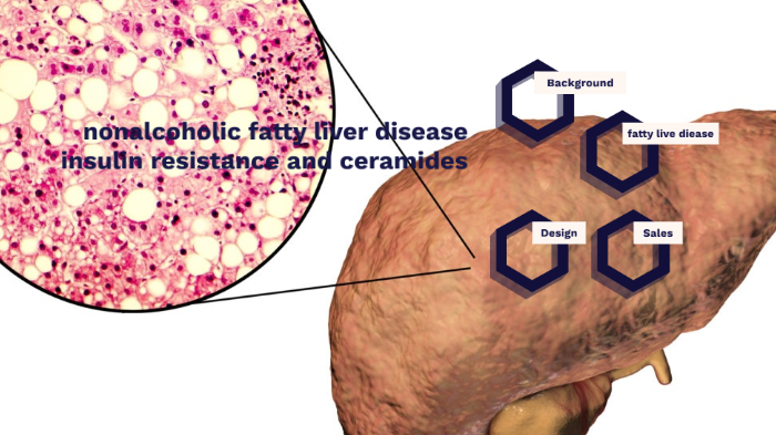 nonalcoholic fatty liver disease insulin resistance and ceramides by ...