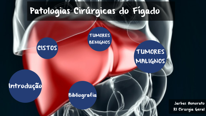 Patologias Cirúrgicas Do Fígado By Jarbas Honorato On Prezi