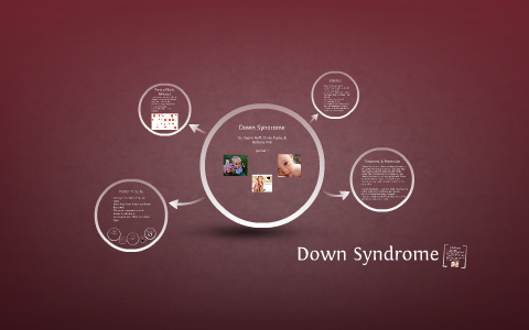 Down Syndrome by taylor neff on Prezi