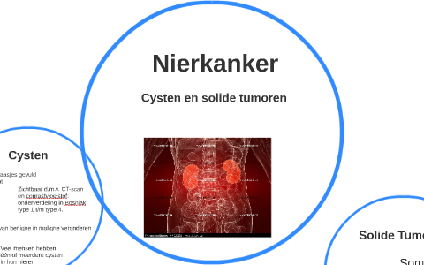 Niercelcarcinoom by Leonie Eenink on Prezi