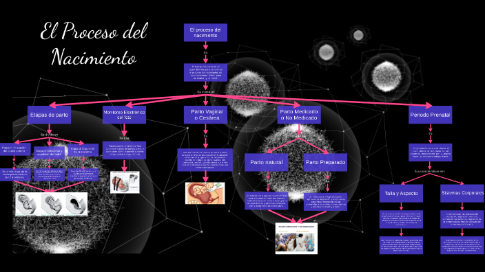 Parto - Recien Nacido/Mapa Conceptual by Ismael López on Prezi Next