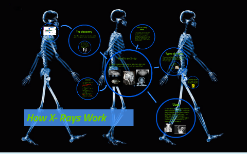 How X- Rays Work by Julie Williams on Prezi