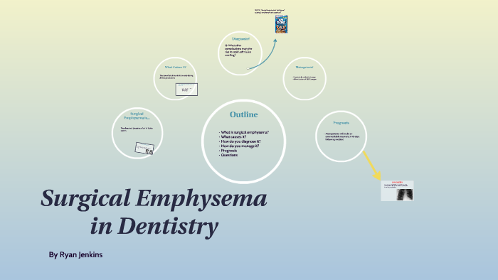 Surgical Emphysema in Dentistry by Ryan Jenkins on Prezi