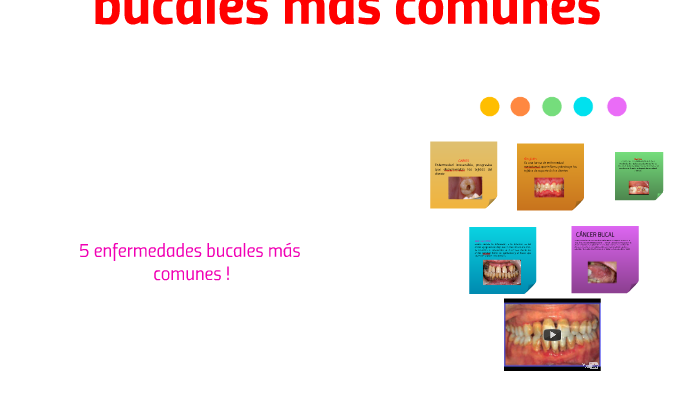 5 Enfermedades Bucales Mas Comunes By Ilce Valencia De La Cruz 7253