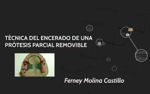 TÉCNICA DEL ENCERADO DE UNA PRÓTESIS PARCIAL REMOVIBLE By FERNEY MOLINA ...