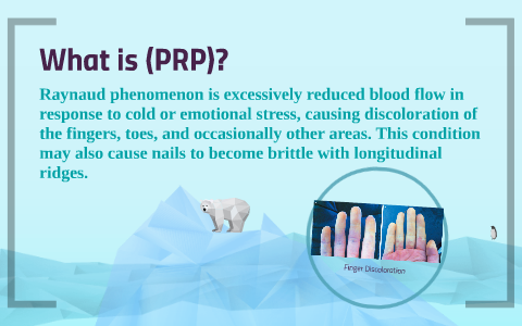 Primary Reynolds Phenomenon by Taylor Salewske on Prezi