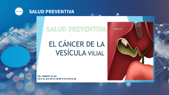 cáncer de la vesícula vilial by shirley loja coello on Prezi