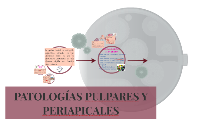 PATOLOGÍAS PULPARES Y PERIAPICALES by Andrea Valladares Carpio on Prezi