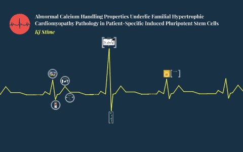 Abnormal Calcium Handling Properties Underlie Familial Hyper by ...