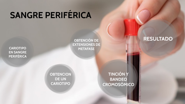 cariotipo sangre periferica by Paula Moreno García on Prezi