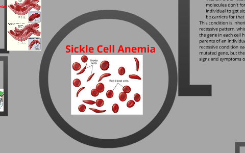 Sickle Cell Anemia by geogre johnson on Prezi