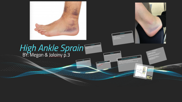 High Ankle Sprain by Jalainy Elyse