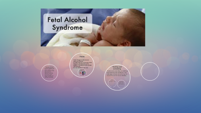 Fetal Alcohol Syndrome by hailey webb on Prezi