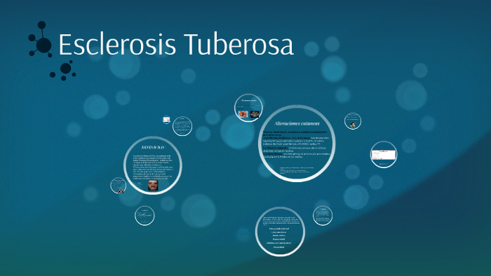 La esclerosis tuberosa (ET) es una enfermedad de origen gené by Pierre ...