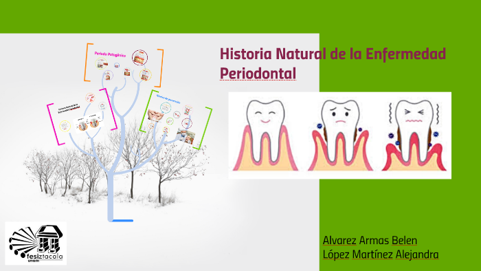 Historia Natural de la Enfermedad Periodontal by belen alvarez armas on