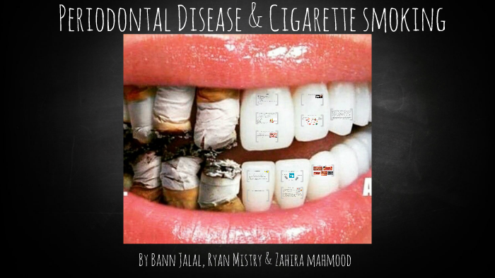 gum disease smoking cigarettes and A General Dentist Explains the