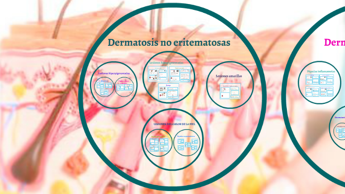 el edema causa nhs