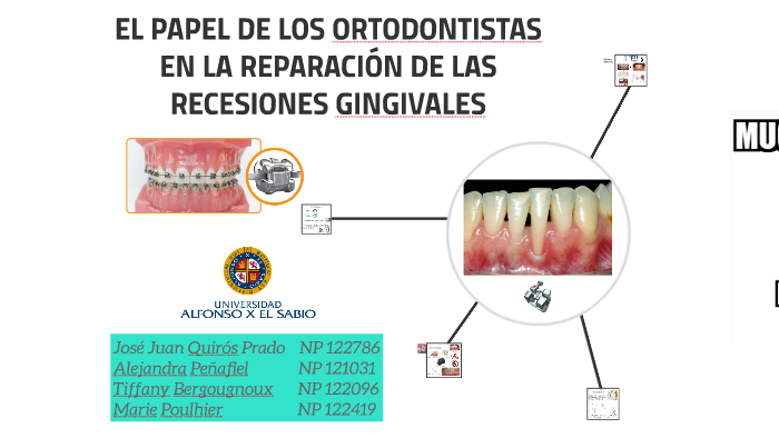 clasificación de la recesión gingival