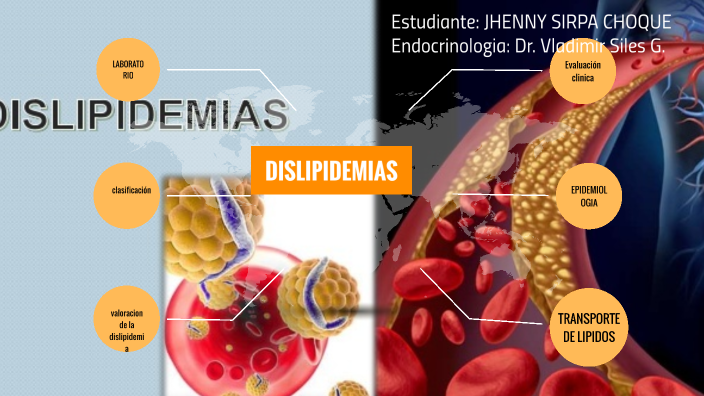 Dislipidemias By Jhenny Sirpa On Prezi 0932