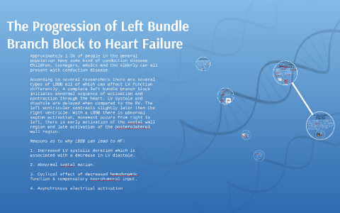The Progression of Left Bundle Branch Block to Heart Failure by Stacey ...