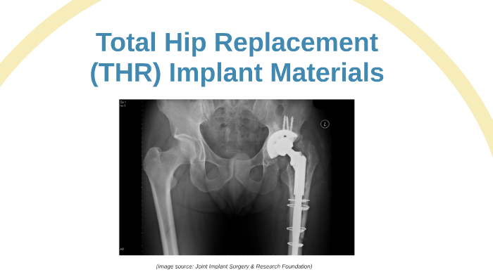 mtrl 201 total hip replacements by dolma tsundu on prezi hip replacements materials