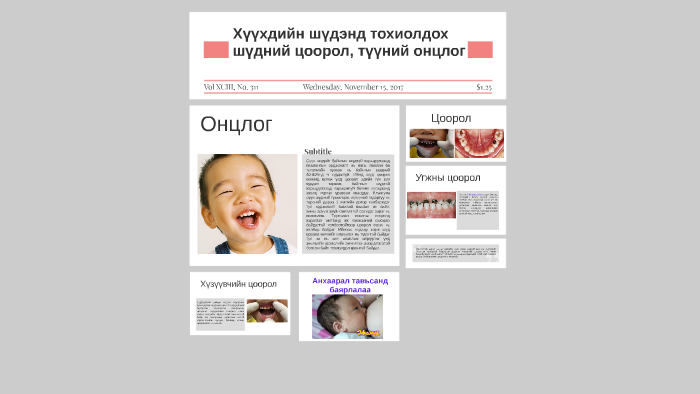хүүхдийн шүдэнд тохиолдох шүдний цоорол түүний онцлогхүүхдий by А ...