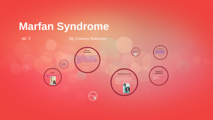 marfan syndrome by Nyrobie Rodriguez