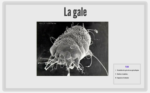 gale croûteuse vs gale non croûteuse