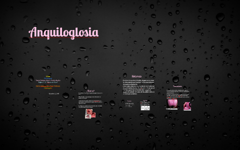 Anquiloglosia by on Prezi