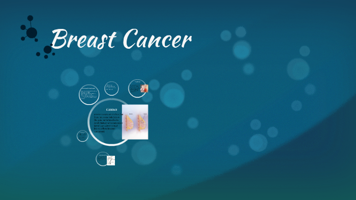 causes of breast cancer by verenice hernandez on Prezi