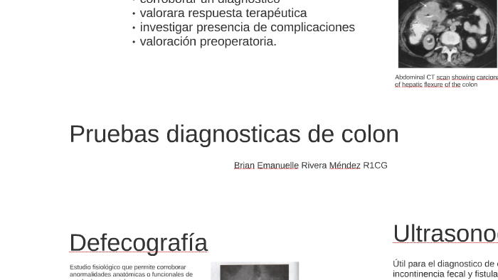 Pruebas diagnosticas de colon by Brian Rivera