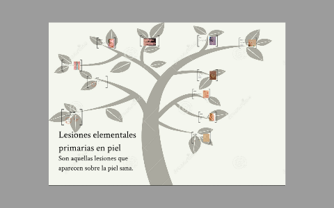 Lesiones Elementales Primarias En Piel By William Morales