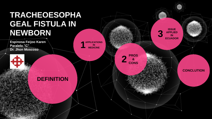 Tracheoesophageal Fistula In Newborn By Soledad Paredes Chagerben On Prezi