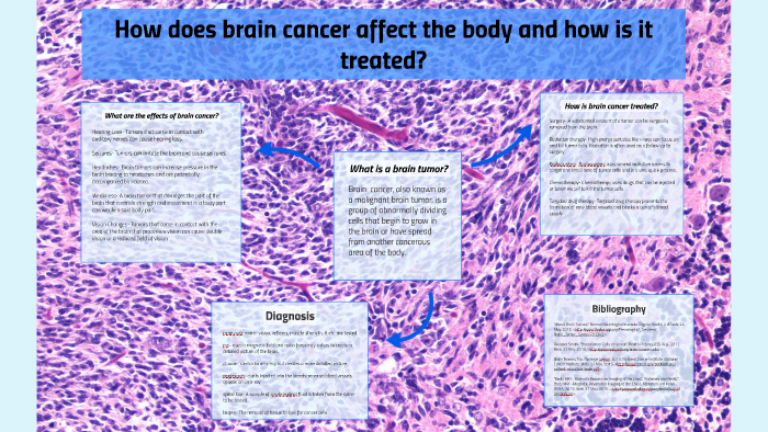 how-does-brain-cancer-affect-the-body-and-how-is-it-treated-by