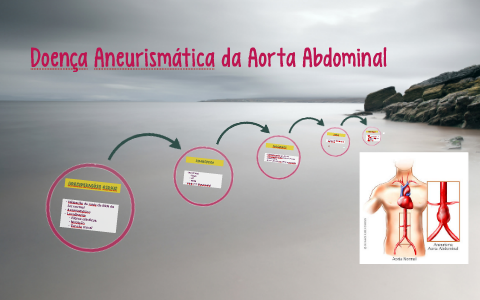 Doença Aneurismática da Aorta Abdominal by Eduardo Dantas