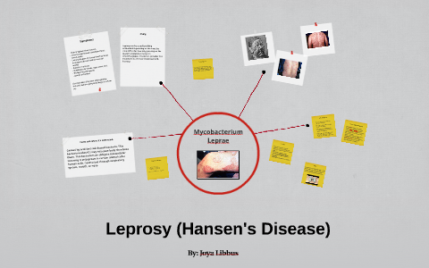 Leprosy (Hansen's Disease) by Joya Libbus