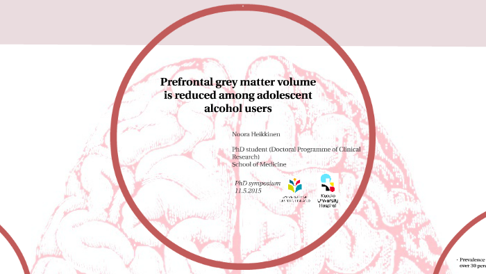 Prefrontal grey matter volume is reduced among adolescent alcohol users ...