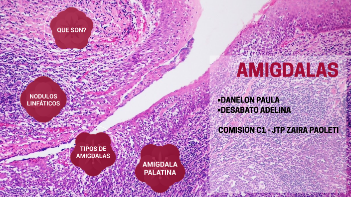 Histología De Las Amígdalas Faríngeas