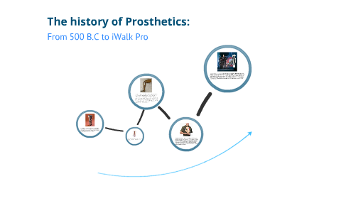 The History Of Prosthetics: By Rosen Zhelev