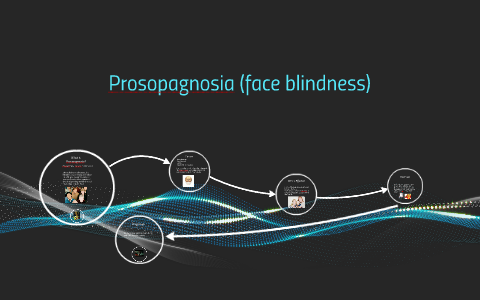 Prosopagnosia (face Blindness) By Adam Arsenault