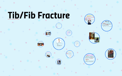 Tib/Fib Fracture by e p on Prezi