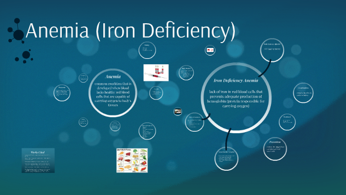 Anemia (Iron Deficiency & Sickle Cell) by Dr. Sam Lalani on Prezi