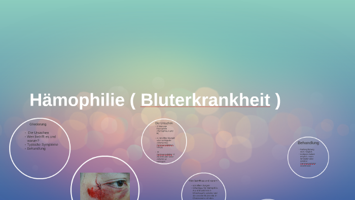 Hämophilie ( Bluterkrankheit ) By Svenja Stolzenberger On Prezi