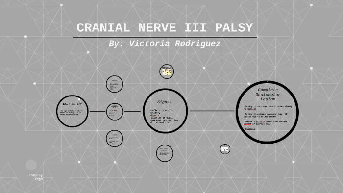 CRANIAL NERVE III PALSY by Victoria Rodriguez on Prezi