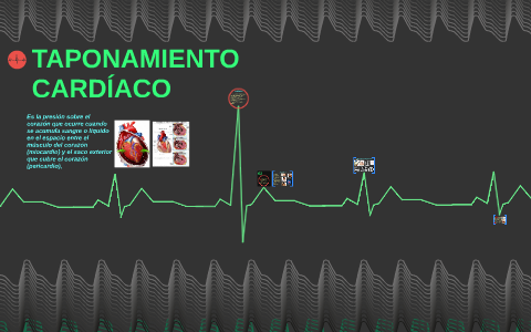 diagrama de taponamiento cardiaco